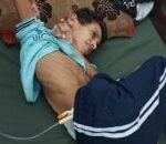 يوسف أبو عمرة: الطفل الفلسطيني المصاب في غزة يواجه خطر الموت الصادم - المهجر نت